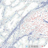 bg_cases02_01